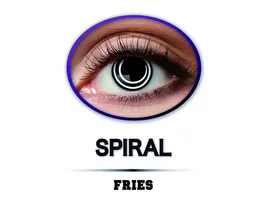 Fries Fun Linsen Spiral